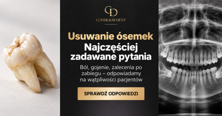 Ząb mądrości i poglądowe zdjęcie rentgenowskie zatrzymanych ósemek – ilustracja do artykułu z odpowiedziami na pytania pacjentów